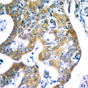 IKB alpha Rabbit Monoclonal Antibody