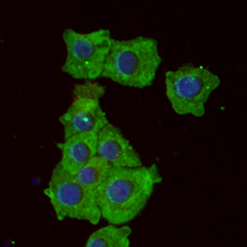 IKB alpha Rabbit Monoclonal Antibody