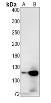 E Cadherin Rabbit Monoclonal Antibody