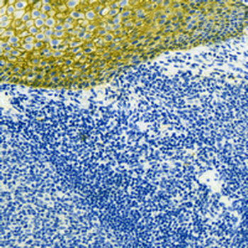 E Cadherin Rabbit Monoclonal Antibody