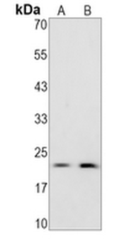 CDC8 Rabbit Monoclonal Antibody