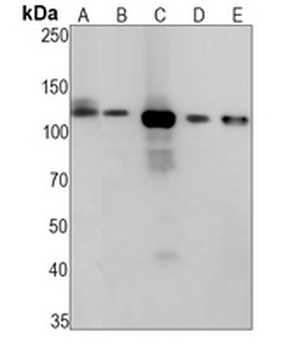 R Cadherin Rabbit Monoclonal Antibody