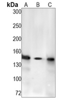 NCAPD2 Rabbit Monoclonal Antibody