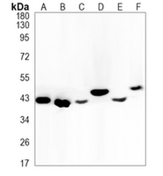 CD79b Rabbit Monoclonal Antibody