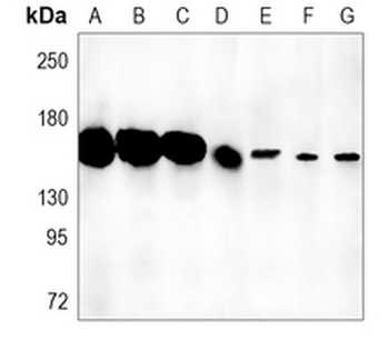 Collagen 3 alpha 1 Rabbit Monoclonal Antibody