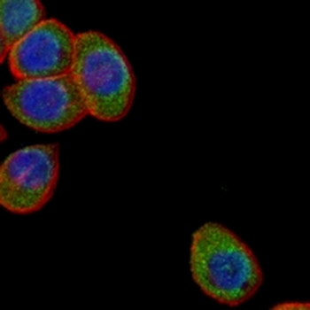 Collagen 3 alpha 1 Rabbit Monoclonal Antibody