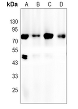 PKC beta Rabbit Monoclonal Antibody