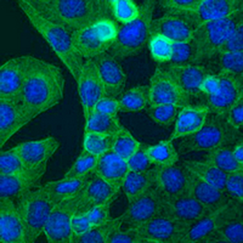 PKC beta Rabbit Monoclonal Antibody
