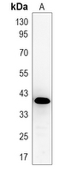 NKX2-1 Rabbit Monoclonal Antibody