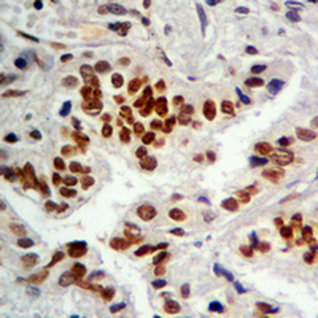 NKX2-1 Rabbit Monoclonal Antibody