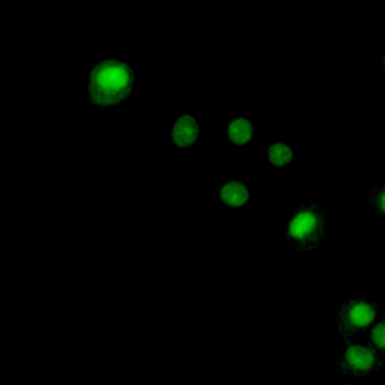 NKX2-1 Rabbit Monoclonal Antibody