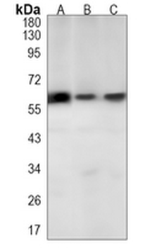 EAAT1 Rabbit Monoclonal Antibody