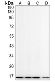 Beta 2 Microglobulin Rabbit Monoclonal Antibody