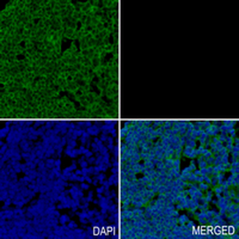 Beta 2 Microglobulin Rabbit Monoclonal Antibody