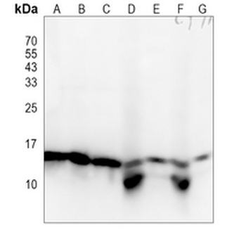 Rbx1 Rabbit Monoclonal Antibody