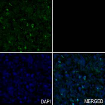 SATB1 Rabbit Monoclonal Antibody