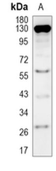 SRD5A2 Rabbit Monoclonal Antibody