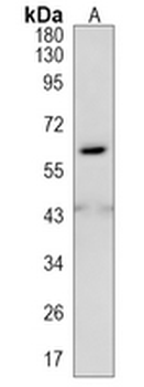 tPA Rabbit Monoclonal Antibody