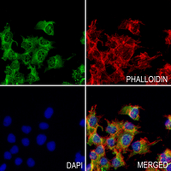 UQCRH Rabbit Monoclonal Antibody
