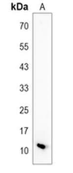 Hemoglobin gamma Rabbit Monoclonal Antibody