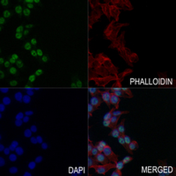 DNMT1 Rabbit Monoclonal Antibody