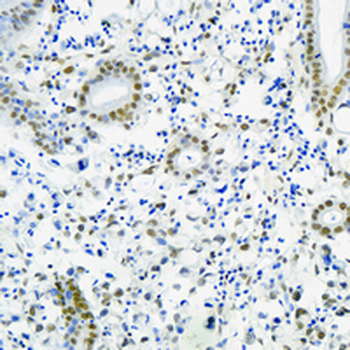 YY1 Rabbit Monoclonal Antibody