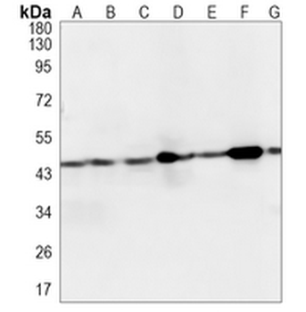 SEC14L2 Rabbit Monoclonal Antibody