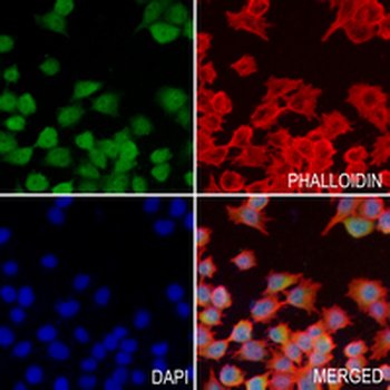 SEC14L2 Rabbit Monoclonal Antibody