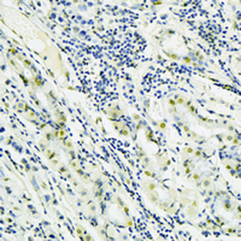 Histone H2B Rabbit Monoclonal Antibody
