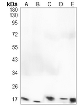 FGF1 Rabbit Monoclonal Antibody