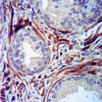 Myosin 11 Rabbit Monoclonal Antibody