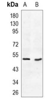 MEF2A/C Rabbit Monoclonal Antibody