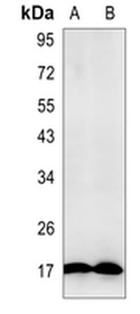 Myoglobin Rabbit Monoclonal Antibody
