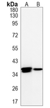 Cathepsin H/K/L/V Rabbit Monoclonal Antibody