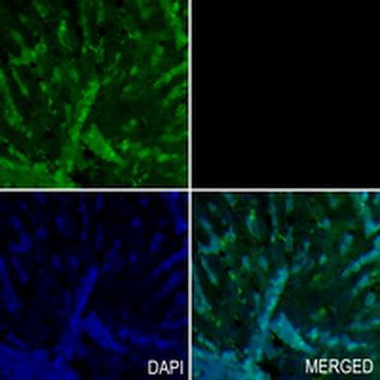 Cathepsin H/K/L/V Rabbit Monoclonal Antibody