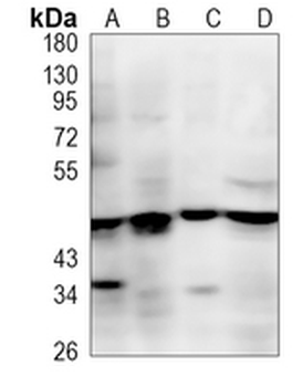 ENTPD5 Rabbit Monoclonal Antibody
