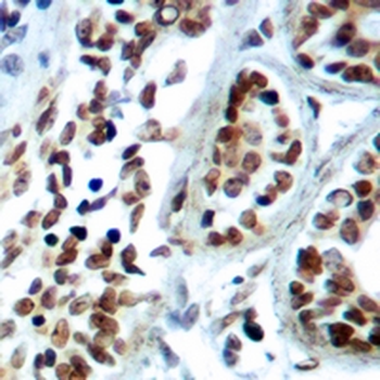 MXD3 Rabbit Monoclonal Antibody