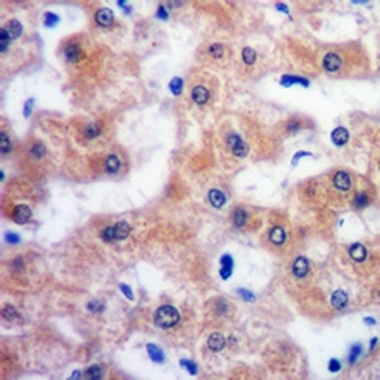FMO3 Rabbit Monoclonal Antibody