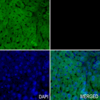 ALDH1A1 Rabbit Monoclonal Antibody