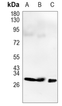 TPSAB1 Rabbit Monoclonal Antibody