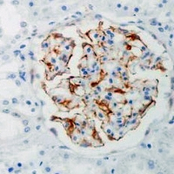 TPSAB1 Rabbit Monoclonal Antibody
