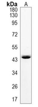 ABHD5 Rabbit Monoclonal Antibody