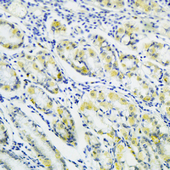 ABHD5 Rabbit Monoclonal Antibody