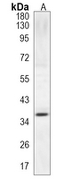 MYF5 Rabbit Monoclonal Antibody