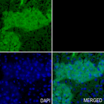 MYH7B Rabbit Monoclonal Antibody