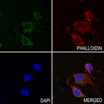 MYH7B Rabbit Monoclonal Antibody