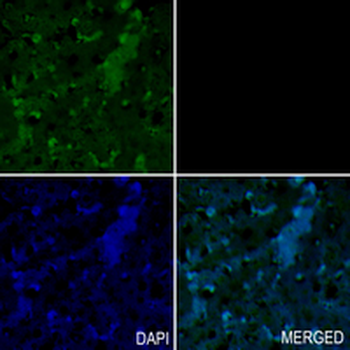 CD71 Rabbit Monoclonal Antibody