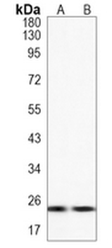 MRAS Rabbit Monoclonal Antibody