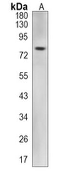 Androgen Receptor Rabbit Monoclonal Antibody