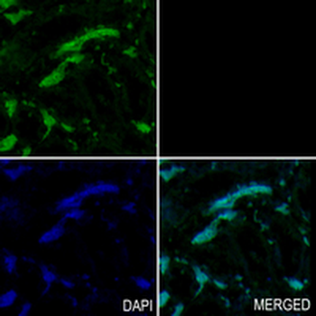 Androgen Receptor Rabbit Monoclonal Antibody